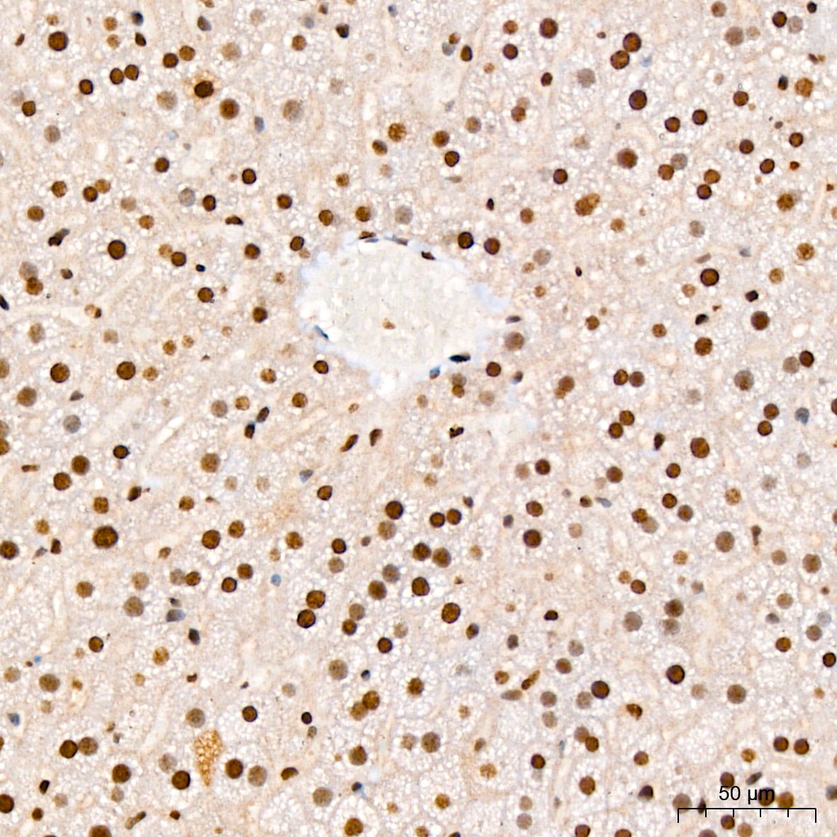 IkB-alpha [p Ser36] Antibody (8G1X10)