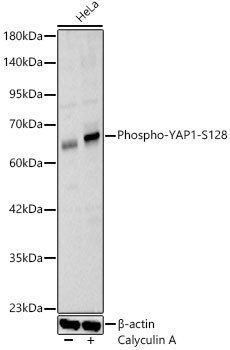 YAP1 [p Ser128] Antibody - Azide and BSA Free