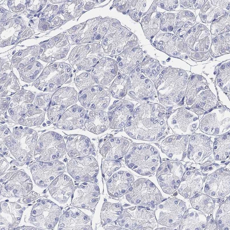 ACRC Antibody - BSA Free Immunohistochemistry-Paraffin: ACRC Antibody [NBP3-17118]