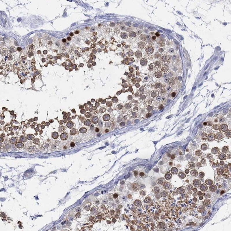 ACRC Antibody - BSA Free Immunohistochemistry-Paraffin: ACRC Antibody [NBP3-17118]