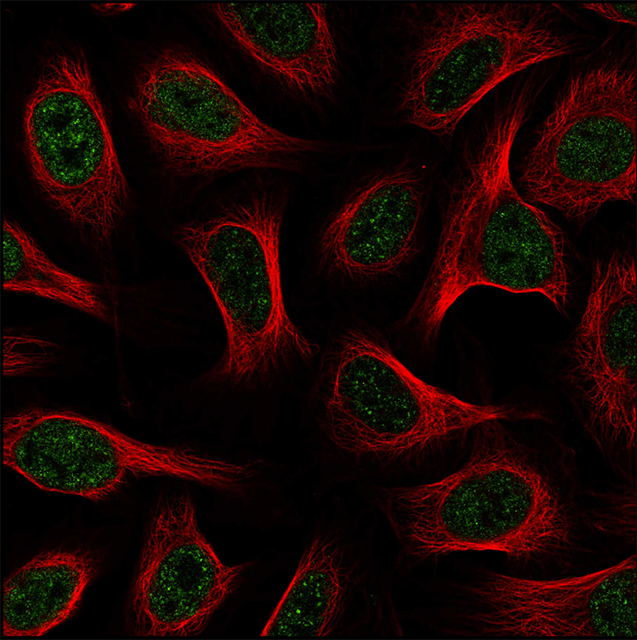RAD26L Antibody - BSA Free Immunocytochemistry/ Immunofluorescence: RAD26L Antibody - BSA Free [NBP3-17300]