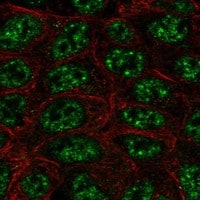 SHANK2 Antibody - BSA Free Immunocytochemistry/ Immunofluorescence: SHANK2 Antibody - BSA Free [NBP3-17310]