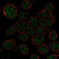 AHDC1 Antibody - BSA Free Immunocytochemistry/ Immunofluorescence: AHDC1 Antibody - BSA Free [NBP3-17335]
