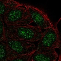 FAM193B Antibody - BSA Free Immunocytochemistry/ Immunofluorescence: FAM193B Antibody - BSA Free [NBP3-17364]