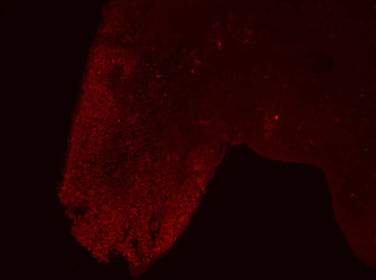 HOXA13 Antibody