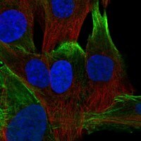 Nexilin Antibody - BSA Free Immunocytochemistry/ Immunofluorescence: Nexilin Antibody [NBP3-17402]