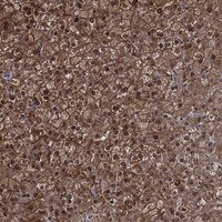 NIT2 Antibody - BSA Free Immunohistochemistry-Paraffin: NIT2 Antibody [NBP3-17403]