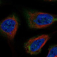 RNF32 Antibody - BSA Free Immunocytochemistry/ Immunofluorescence: RNF32 Antibody - BSA Free [NBP3-17430]