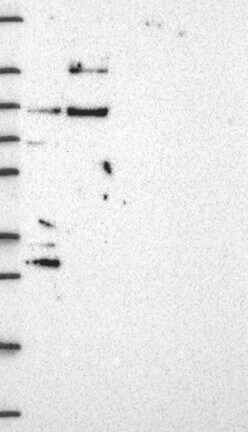 GATSL3 Antibody - BSA Free Western Blot: GATSL3 Antibody - BSA Free [NBP3-17496]