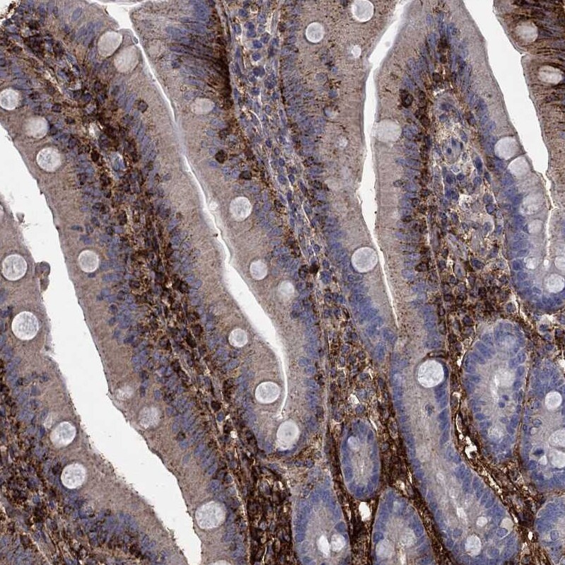 Apolipoprotein CIII Antibody Immunohistochemistry-Paraffin: Apolipoprotein CIII Antibody [NBP3-17685] -