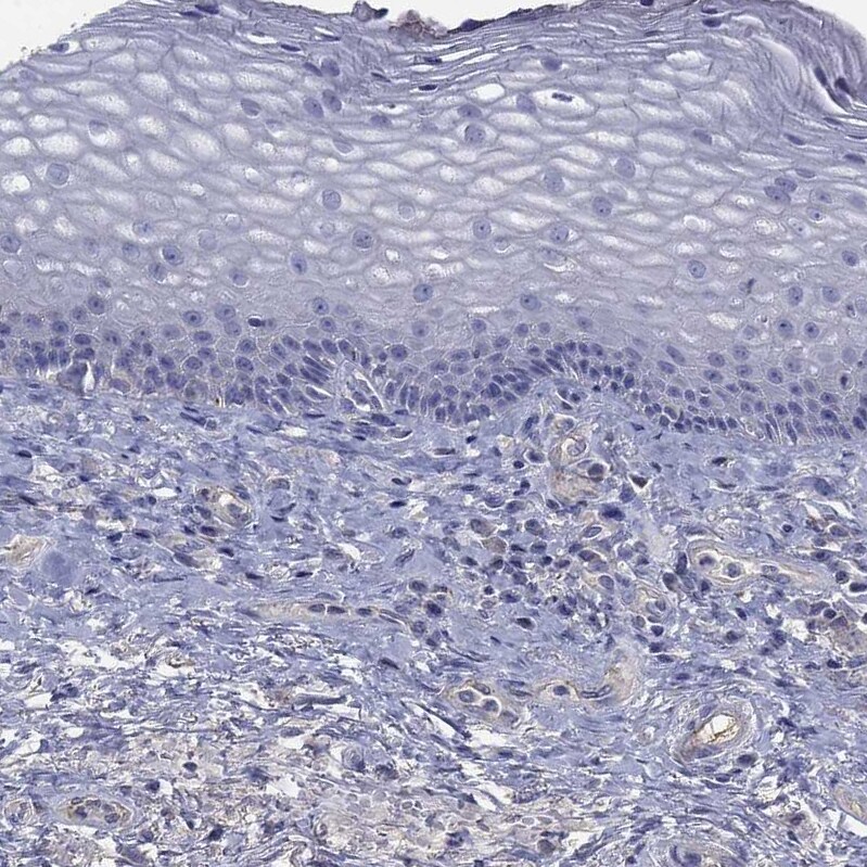 Apolipoprotein CIII Antibody Immunohistochemistry-Paraffin: Apolipoprotein CIII Antibody [NBP3-17685] -