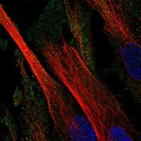 CD109 Antibody - BSA Free Immunocytochemistry/ Immunofluorescence: CD109 Antibody - BSA Free [NBP3-17814]