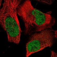 FRA-1/FOSL1 Antibody - BSA Free Immunocytochemistry/ Immunofluorescence: FRA-1/FOSL1 Antibody - BSA Free [NBP3-17851]