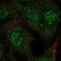 KvBeta1 Antibody - BSA Free Immunocytochemistry/ Immunofluorescence: KvBeta1 Antibody - BSA Free [NBP3-17876]