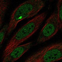 MCPH1 Antibody - BSA Free Immunocytochemistry/ Immunofluorescence: MCPH1 Antibody [NBP3-17888]