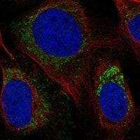 YF5 Antibody - BSA Free Immunocytochemistry/ Immunofluorescence: YF5 Antibody - BSA Free [NBP3-17964]
