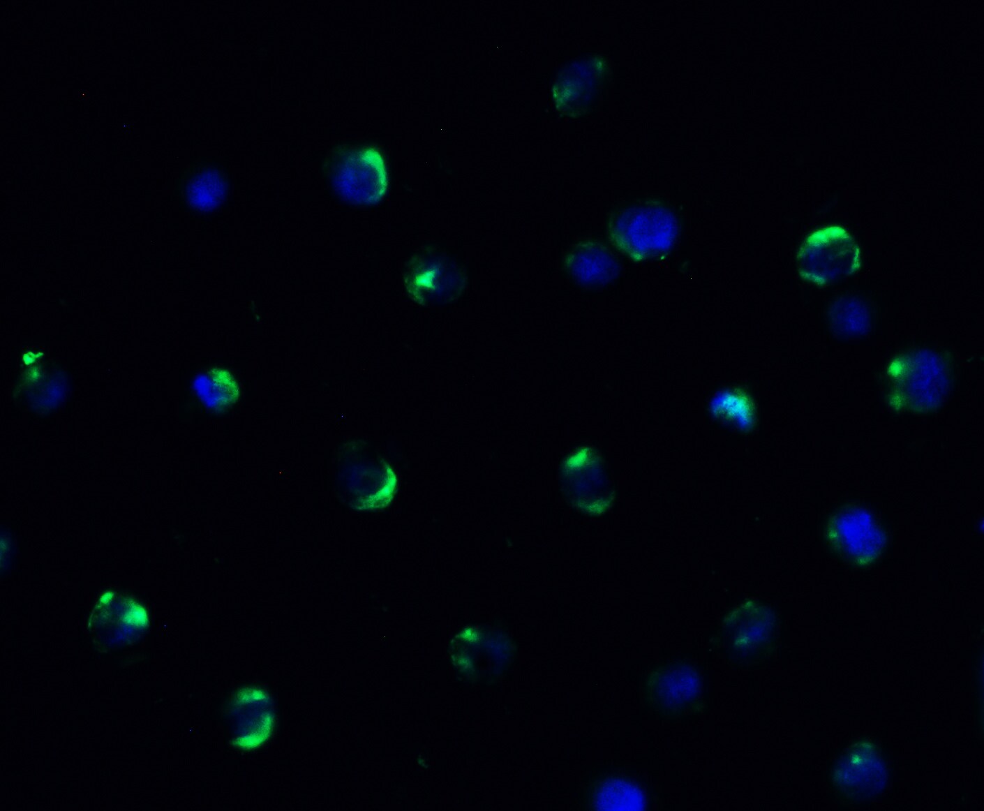 AMID Antibody - BSA Free