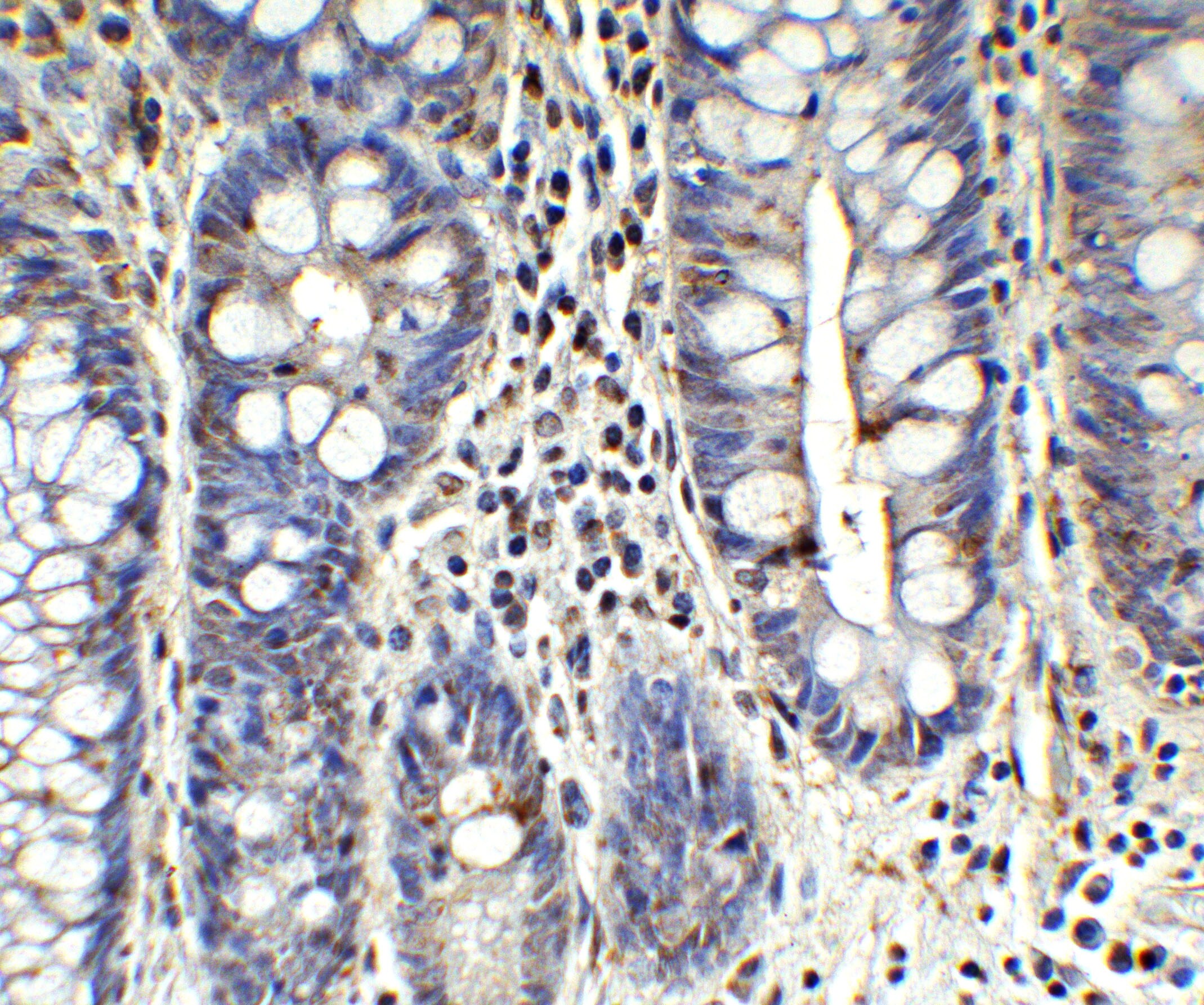 MCPIP1/ZC3H12A Antibody - BSA Free