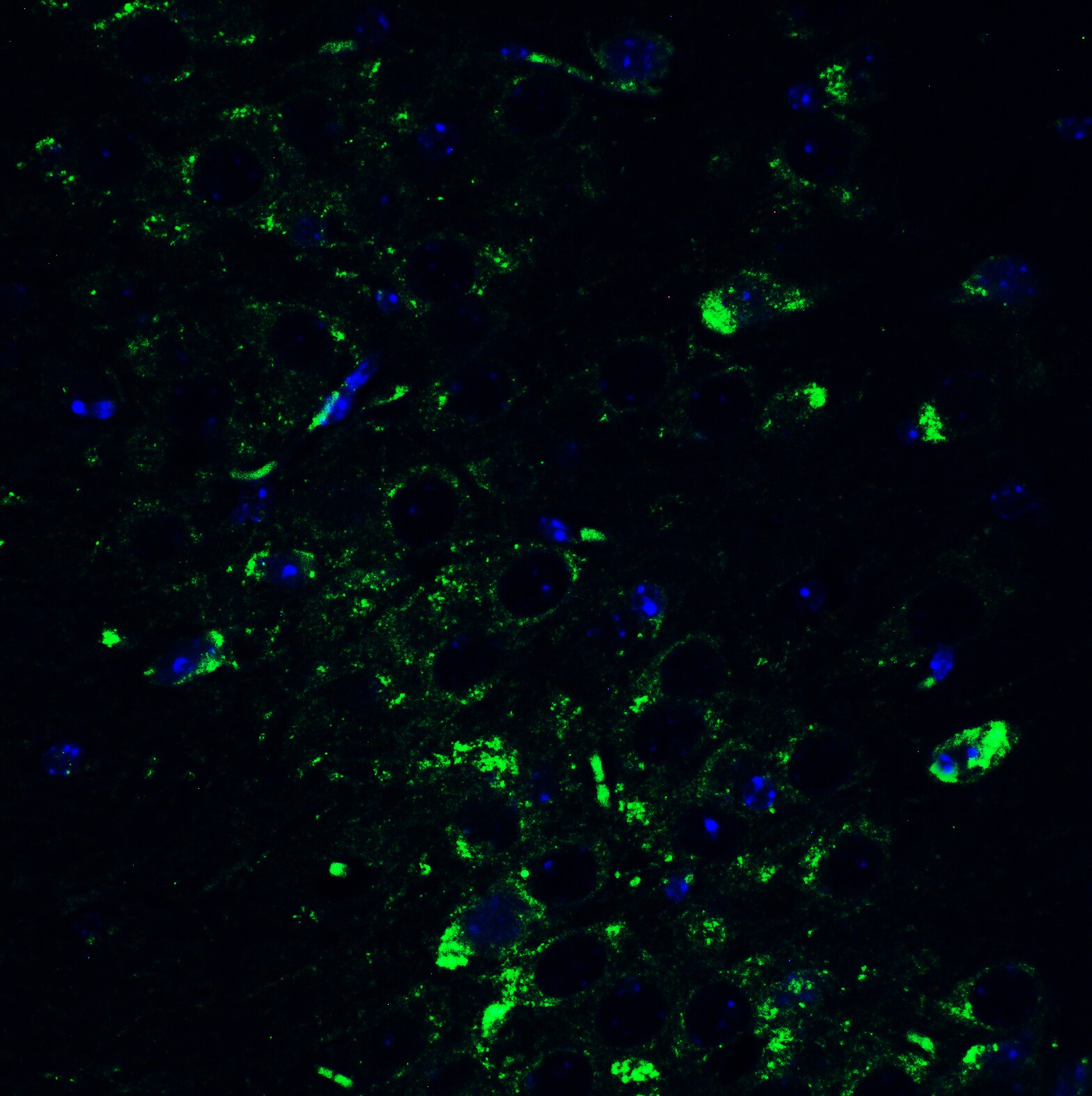mtRNA polymerase Antibody - BSA Free