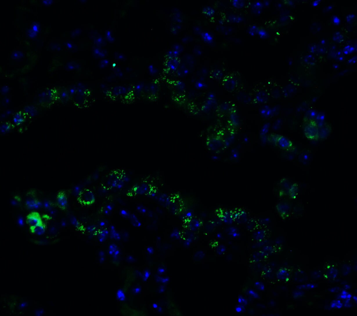 Frizzled-6 Antibody - BSA Free