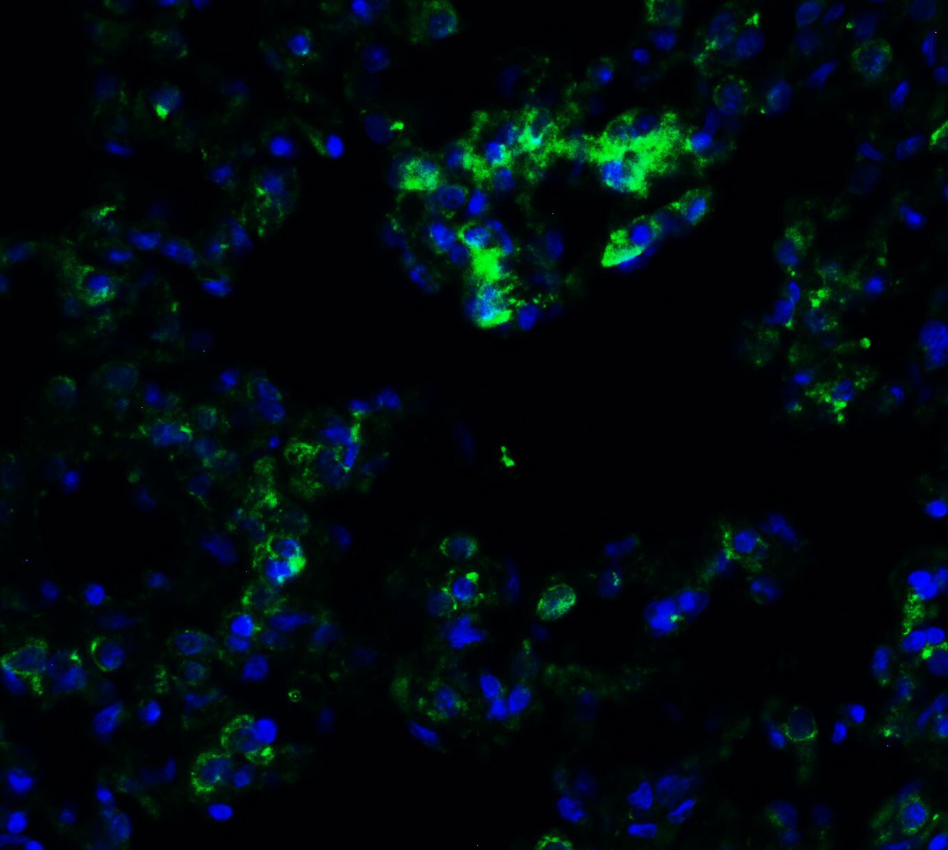 Frizzled-6 Antibody - BSA Free
