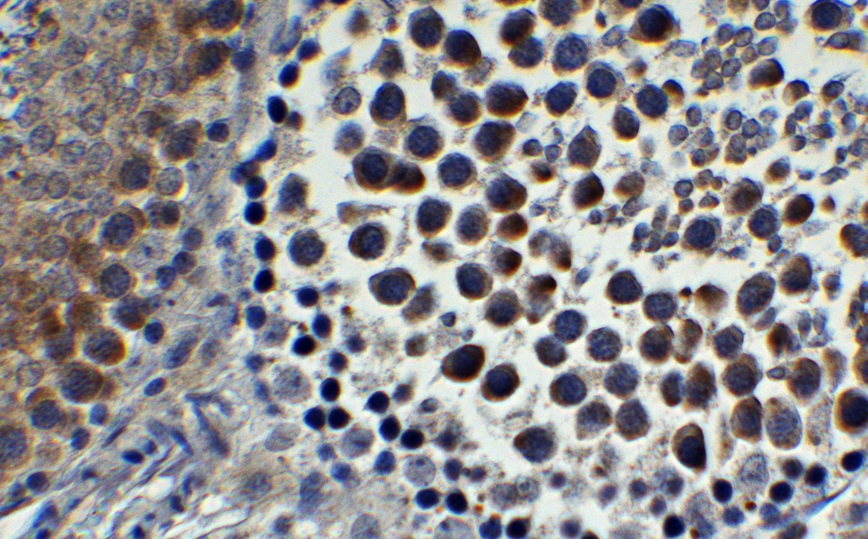 IFI16 Antibody - BSA Free