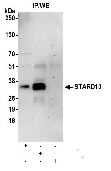 STARD10 Antibody