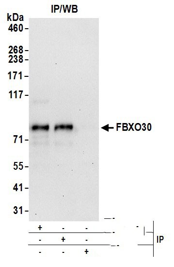 FBXO30 Antibody
