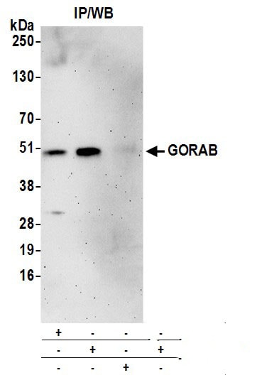 SCYL1BP1 Antibody