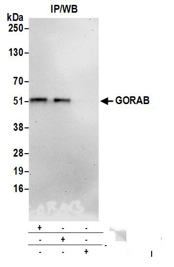 SCYL1BP1 Antibody