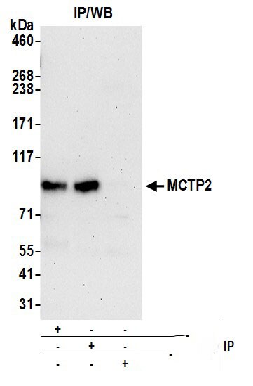 MCTP2 Antibody