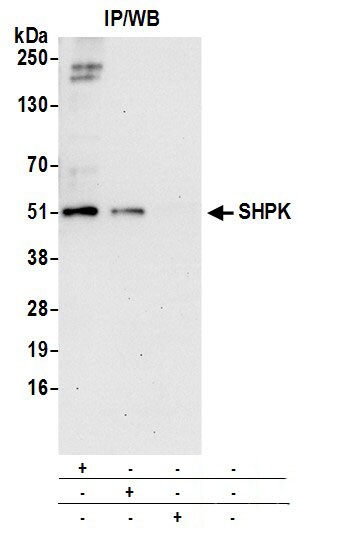 CARKL Antibody