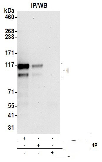 CCDC186 Antibody