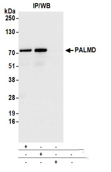 PALMD Antibody