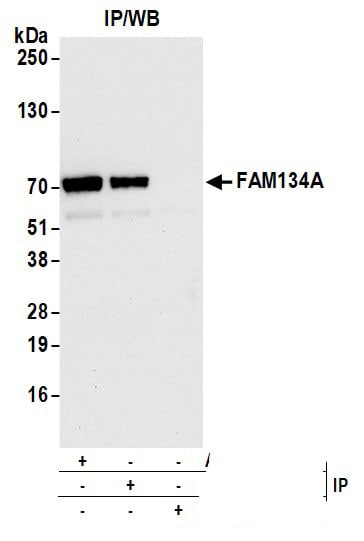 FAM134A Antibody