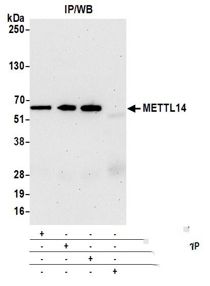 METTL14 Antibody