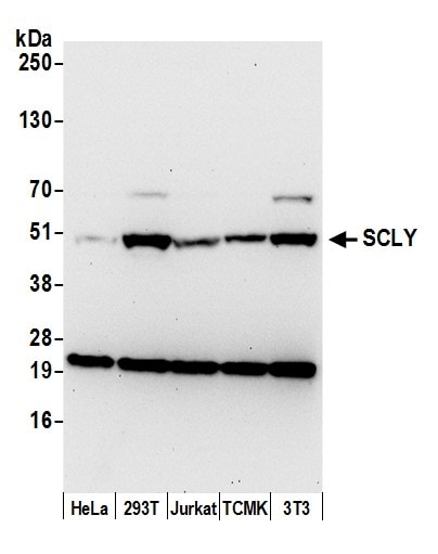SCLY Antibody