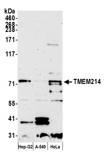 TMEM214 Antibody