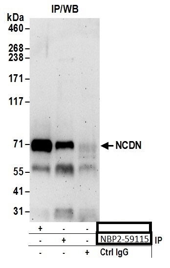 Neurochondrin Antibody