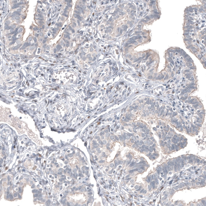 FOXL2 Antibody (CL12762) - BSA Free Immunohistochemistry: FOXL2 Antibody (CL12762) - BSA Free [NBP3-18544]