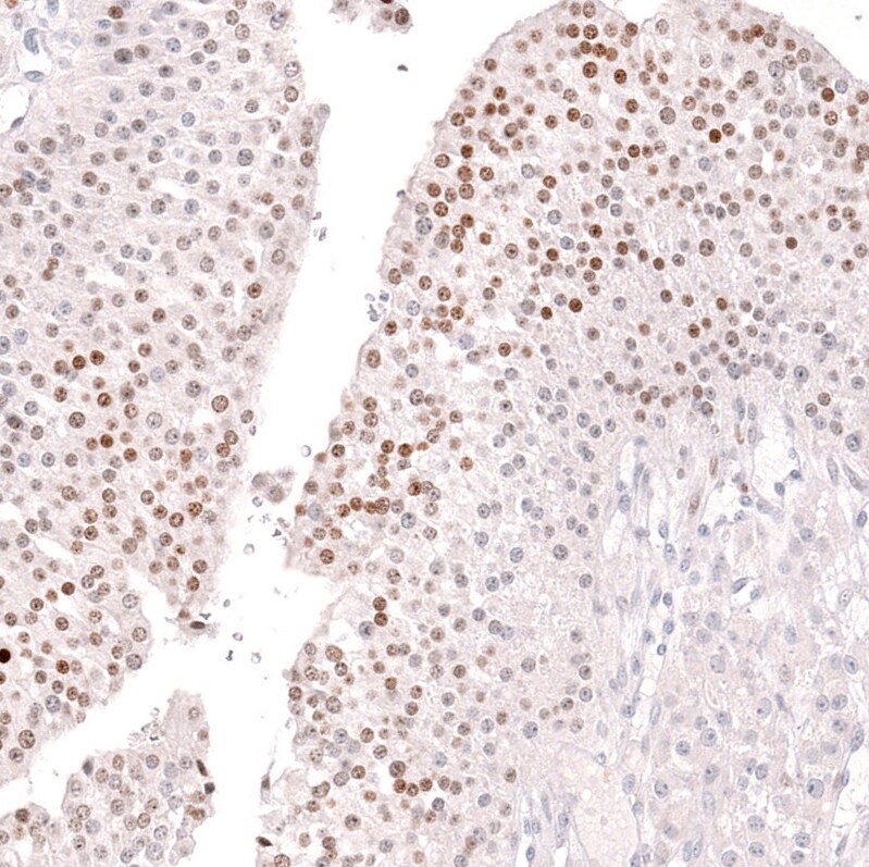 FOXL2 Antibody (CL12762) - BSA Free Immunohistochemistry: FOXL2 Antibody (CL12762) - BSA Free [NBP3-18544]