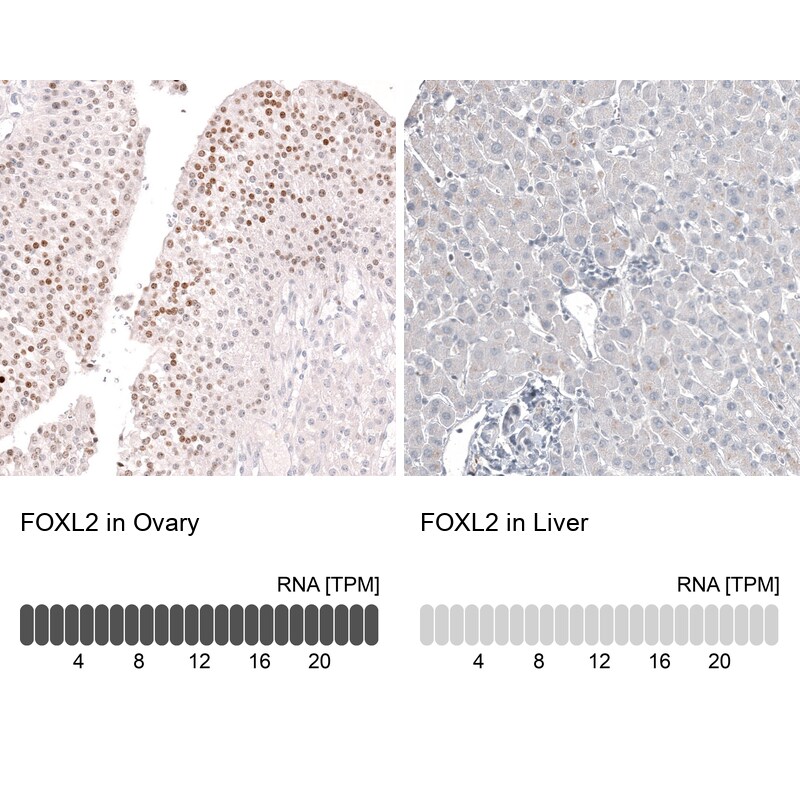 FOXL2 Antibody (CL12762) - BSA Free Immunohistochemistry: FOXL2 Antibody (CL12762) - BSA Free [NBP3-18544]