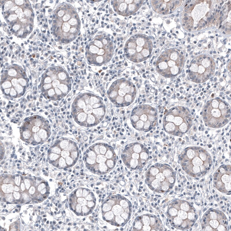 FOXL2 Antibody (CL12762) - BSA Free Immunohistochemistry: FOXL2 Antibody (CL12762) - BSA Free [NBP3-18544]