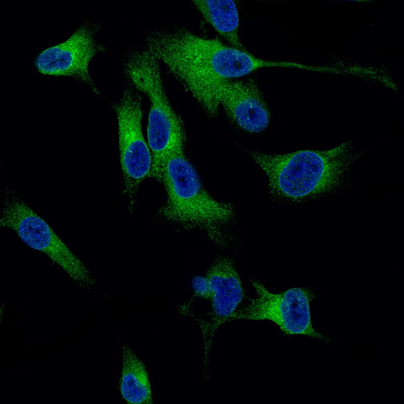 Melan-A/MART-1 Antibody (CL12874) - BSA Free Immunocytochemistry/ Immunofluorescence: Melan-A/MART-1 Antibody (CL12874) [NBP3-18548]