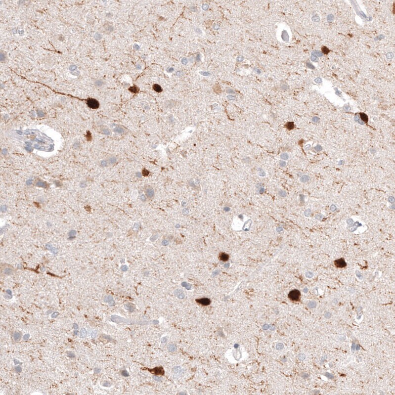Calretinin Antibody (CL12838) - BSA Free Immunohistochemistry-Paraffin: Calretinin Antibody (CL12838) [NBP3-18561]