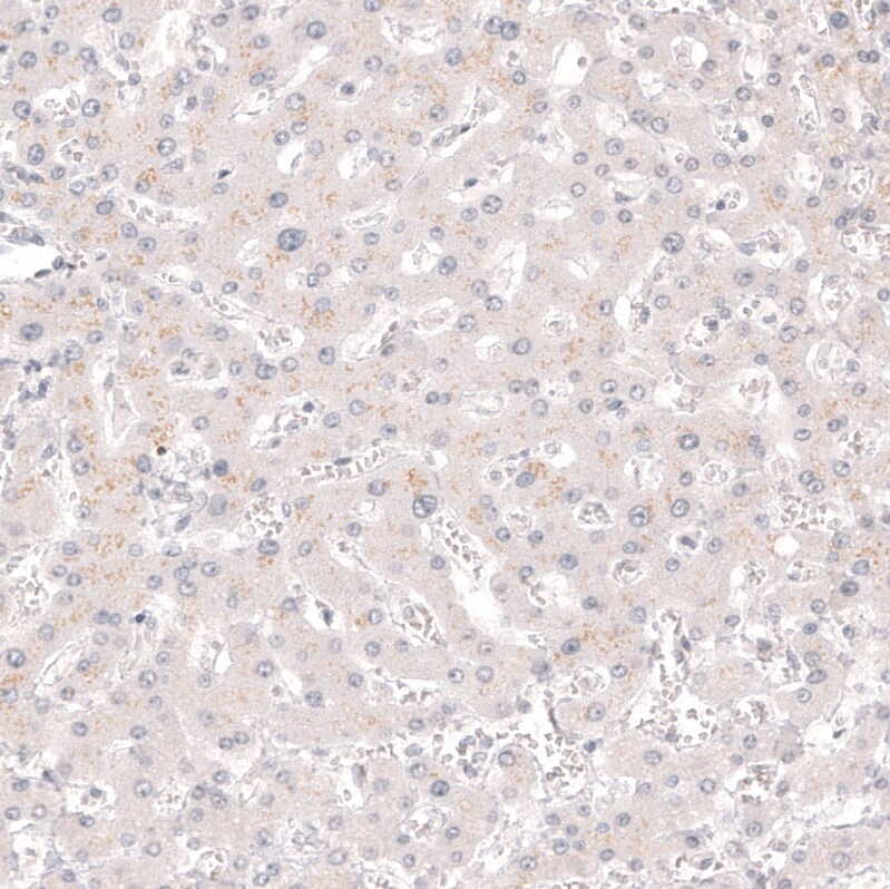 Calretinin Antibody (CL12838) - BSA Free Immunohistochemistry-Paraffin: Calretinin Antibody (CL12838) [NBP3-18561]