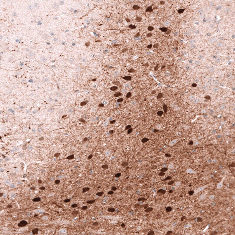 Calretinin Antibody (CL12838) - BSA Free Immunohistochemistry-Paraffin: Calretinin Antibody (CL12838) [NBP3-18561]