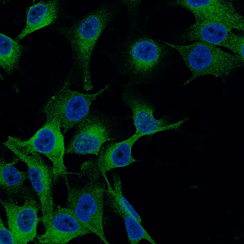 Melan-A/MART-1 Antibody (CL12864) - BSA Free Immunocytochemistry/ Immunofluorescence: Melan-A/MART-1 Antibody (CL12864) [NBP3-18562]