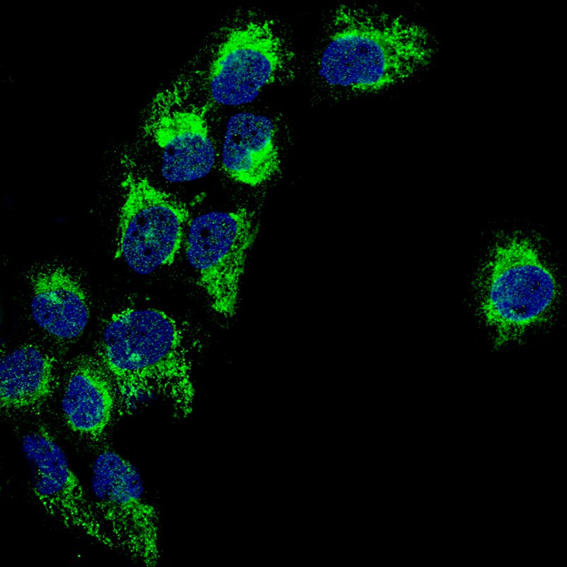 PBR Antibody (CL13358) - BSA Free Immunocytochemistry/ Immunofluorescence: PBR Antibody (CL13358) [NBP3-18567]