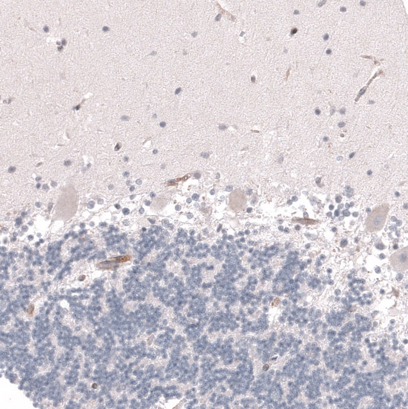 VMAT2 Antibody (CL12531) - BSA Free Immunohistochemistry: VMAT2 Antibody (CL12531) - BSA Free [NBP3-18570]